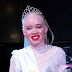 Ratu Cantik Albino Zimbabwe Optimis Perjuangkan Hak, Beri Inspirasi