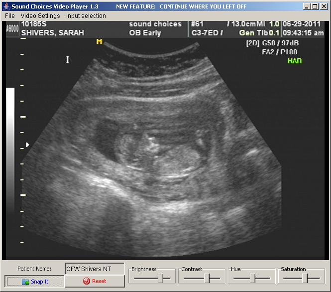 My Image 21