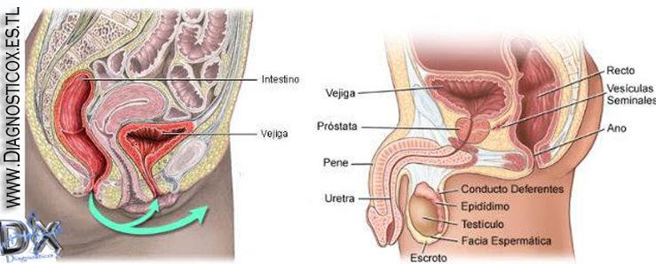 inflamación de la próstata que hace nylon