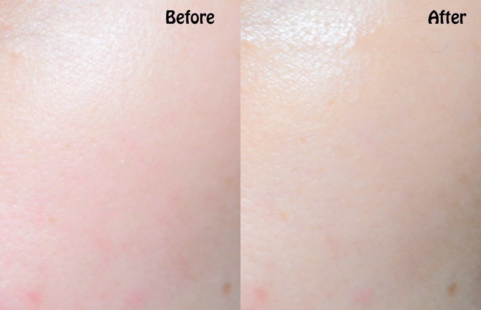 REVIEW Klairs Freshly Juiced Vitamin E Mask Fading Acne Scars