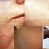 How To Minimize Large Pores Due To Blackheads With Just Water