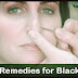 How To Prevent Blackheads | Home Remedies For Blackheads