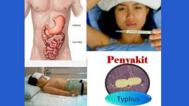Beginilah Cara Ampuh Menghilangkan Penyakit Tipus Atau Tipes dengan Alami Beginilah Cara Ampuh Menghilangkan Penyakit Tipus Atau Tipes dengan Alami