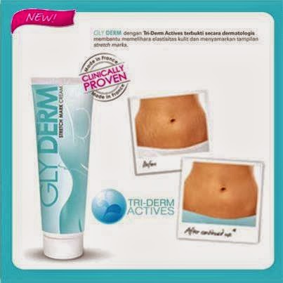 glyderm stretch mark