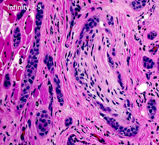 Digital pathology image captured with Infinity 2-5 microscope CCD camera.