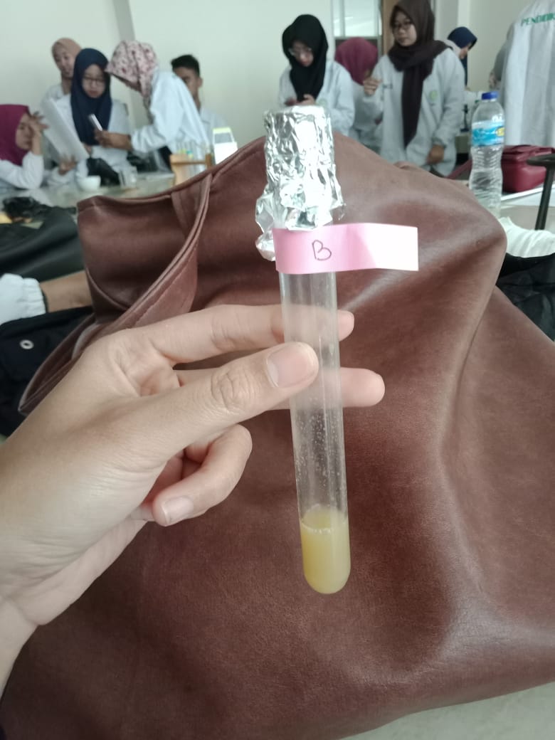 PEMBAHASAN LAPORAN PRAKTIKUM ENZIM KATALASE