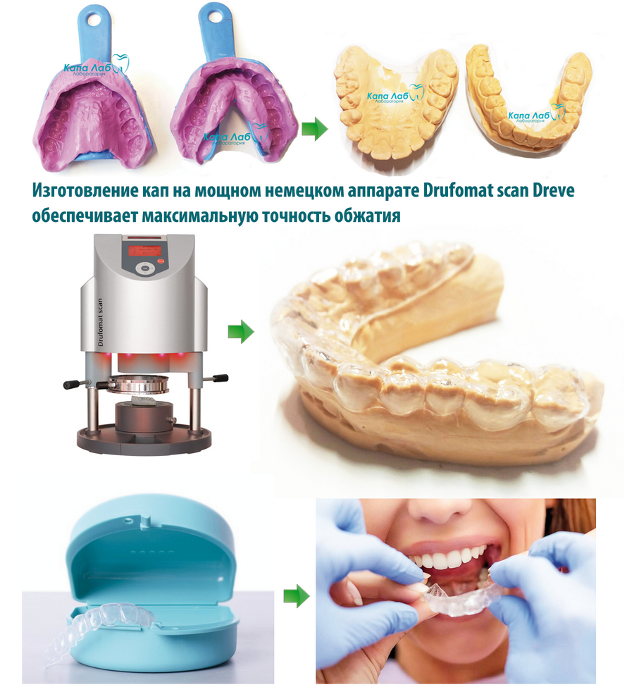 Tv-013 отбеливатель зубов white light. Зубные капы для отбеливания. Виды кап. Капа для карате. Виды кап.