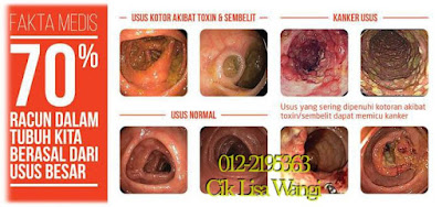 Set Detoks Shaklee