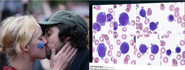EXPOSED: Kissing Could Cause Infertility! Shocking! EXPOSED: Kissing Could Cause Infertility! Shocking!
