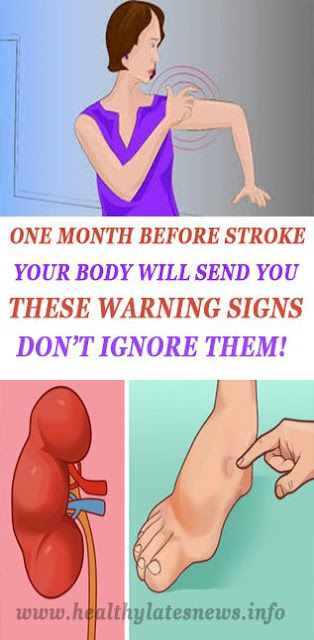 ONE MONTH BEFORE STROKE, YOUR BODY WILL SEND YOU THESE WARNING SIGNS – DON’T IGNORE THEM!