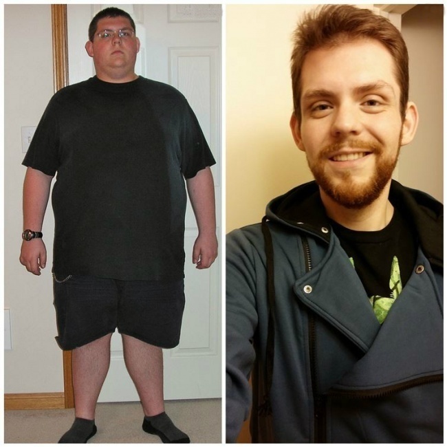 #2. Gaining weight can totally affect the way that you look. - 23 Inspirational Before/After Photos Of People Who Can Say 'I Did It.' #2. Gaining weight can totally affect the way that you look. - 23 Inspirational Before/After Photos Of People Who Can Say 'I Did It.'