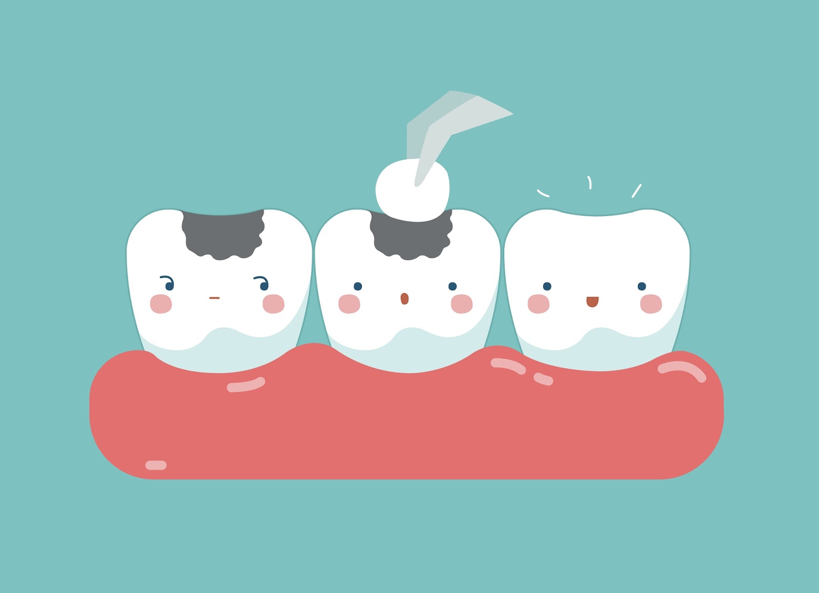 How Do Dental Fillings Work? AMPD Long Island, NY