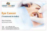 Eye Cancer Treatment  India