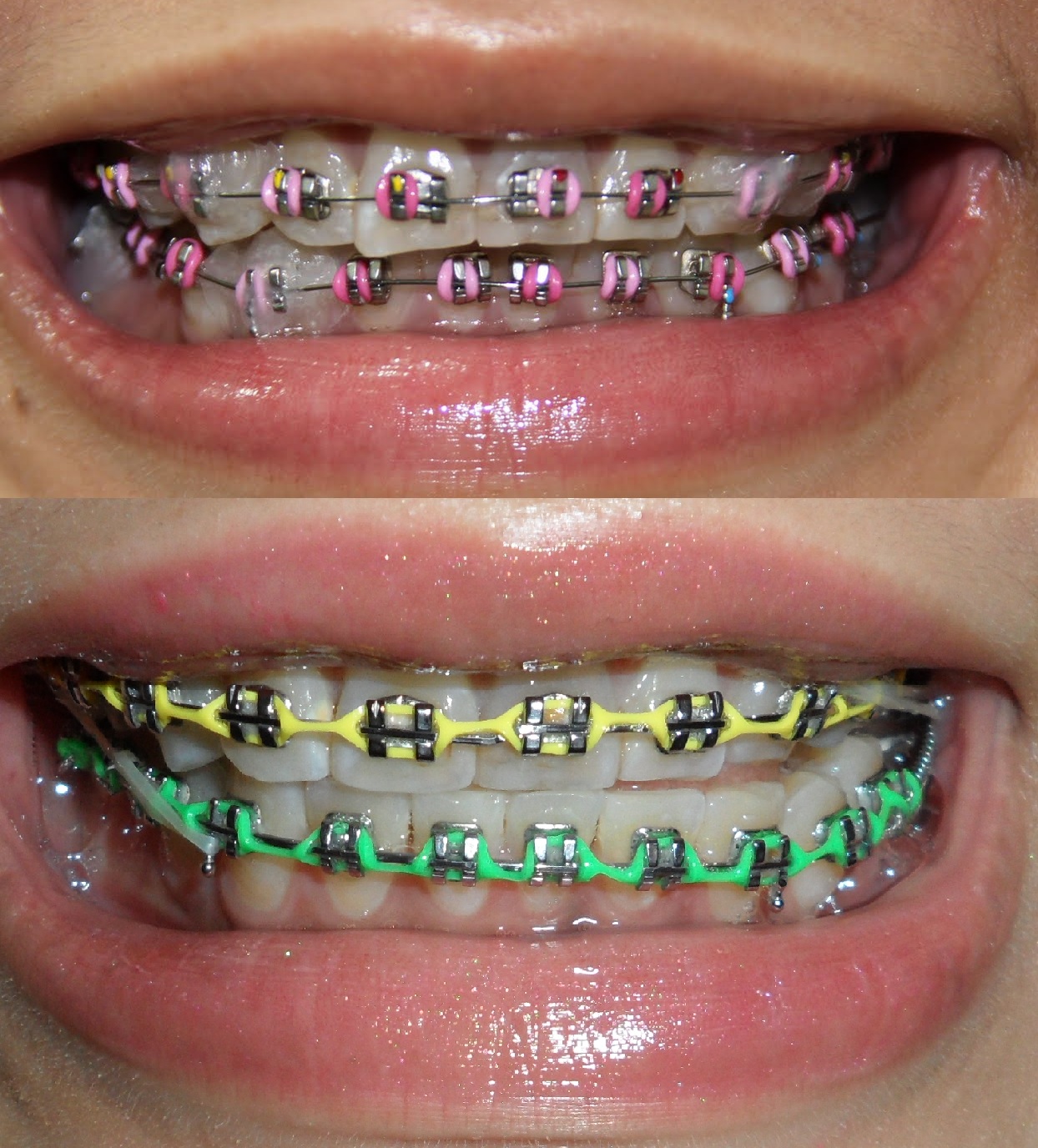 good color combinations braces color wheel good color combinations braces color wheel