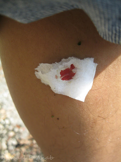 Wound made by the leech of Phukhieo Wildlife Sanctuary
