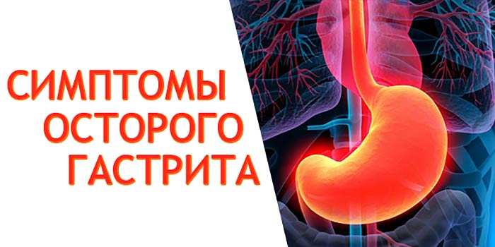 Симптомы острого гастрита