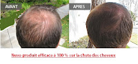 nuvo plus sûre et efficace en matière de repousse capillaire nuvo efficace en matière de repousse capillaire