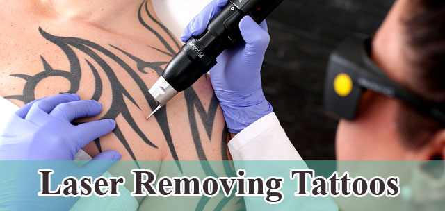 Tips bagaimana cara menghapus tato sampai benar-benar hilang cara menghapus tato sampai benar-benar hilang
