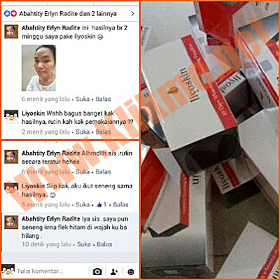 Cara Jitu Atasi Melasma Pada Wajah Cara Jitu Atasi Melasma Pada Wajah