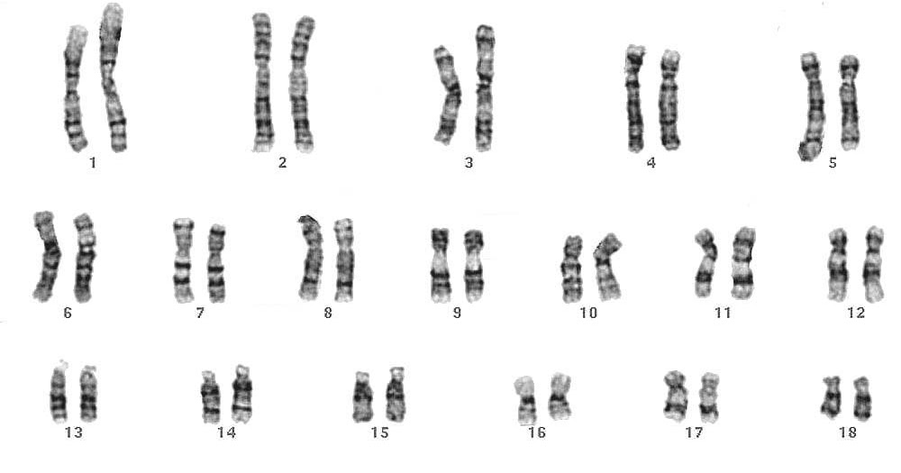 GonzálezEliecerCMC Los cromosomas