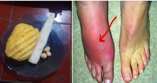 obat asam urat