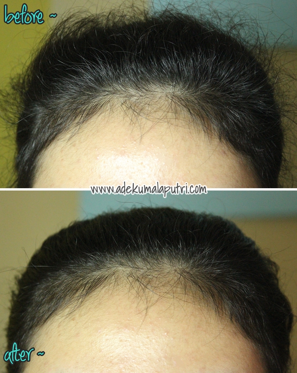 Lala S Wonderland Beauty Blogger Indonesia Tips Tame Flyaways Err I Do Not Know Why But Love My Baby Hairs So Let Them Stay Down You Can Also Tame Your Around Hairline With The Same Step
