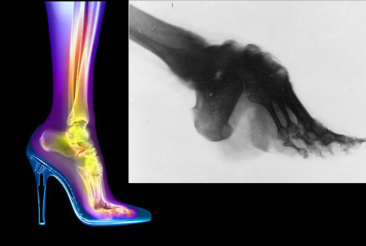 High Heels Are The Worst Kind Of Shoe High Heels Are The Worst Kind Of Shoe