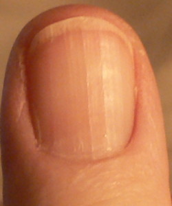What Do Ridges In Fingernails Mean Awesome Nail What Do Ridges In Fingernails Mean