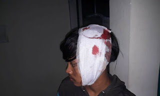 Malam Mingguan Membawa Petaka Malam Mingguan Membawa Petaka