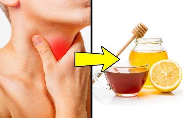 Manfaat Buah Lemon Untuk Kesehatan dan Kecantikan