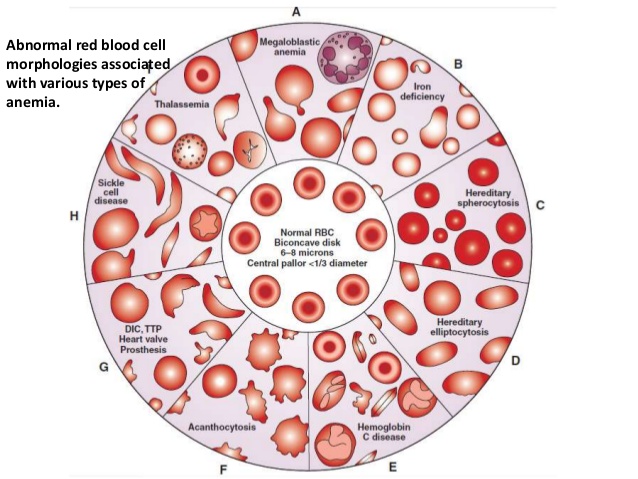rbc morphology abnormal