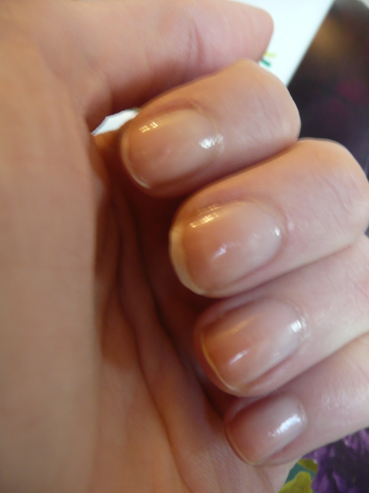 Nail Designs: Poor, weak, brittle nails.