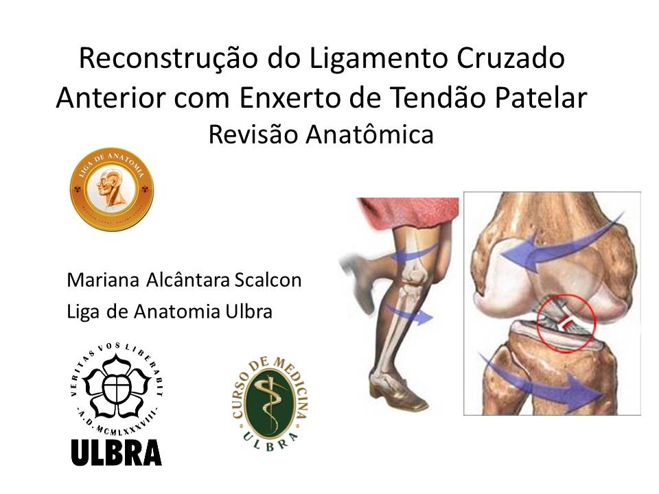 Liga de Anatomia ULBRA RECONSTRUÇÃO DO LIGAMENTO CRUZADO ANTERIOR COM ENXERTO DE TENDÃO PATELAR