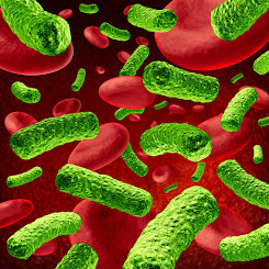 Infeksi Darah Pengobatan Sepsis Secara Alami