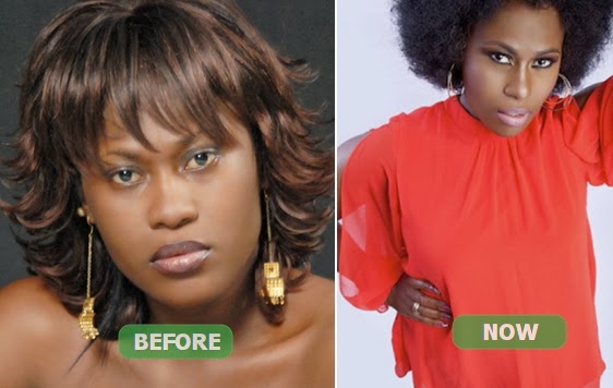uche jombo nose surgery