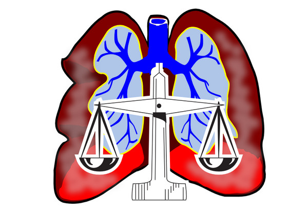 Mesothelioma Law Permits Patient to Avail a Mestohelium Lawyer