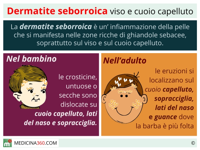 Eczema della pelle di clinica