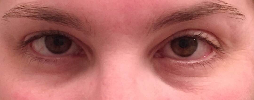 3 minute eye lift cream