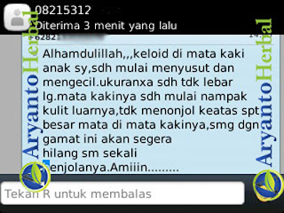 Obat Benjolan Keloid Obat Benjolan Keloid