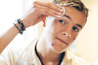 Boys ke pimple remove karne ke upyogi tips aur gharelu nuskhe. Boys ke pimple remove karne ke upyogi tips aur gharelu nuskhe.