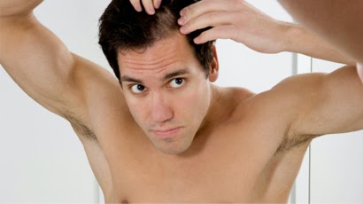 Hair Loss In Men