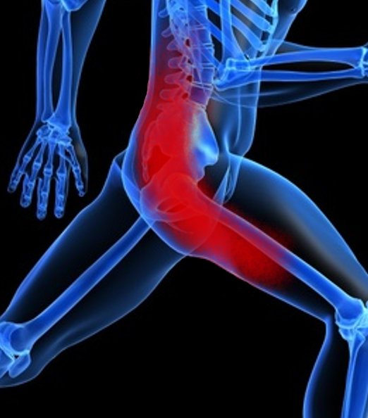 Pinched Nerve Cure Natural Pinched Nerve Cure Natural