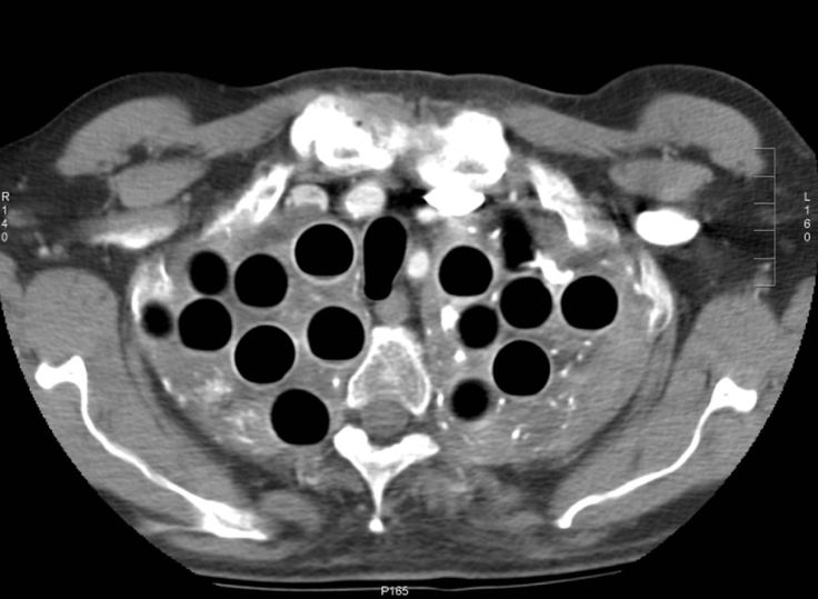 oldfoolrn chest ct mystery chest ct