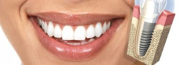 Innovación-avances-dentales-Ciro-Garnica Innovación-avances-dentales-Ciro-Garnica