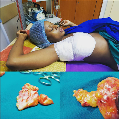 Makosi%2B2 Former Big Brother U.K contestant, Makosi Musambasi undergoes success surgery to remove lumps from her breast