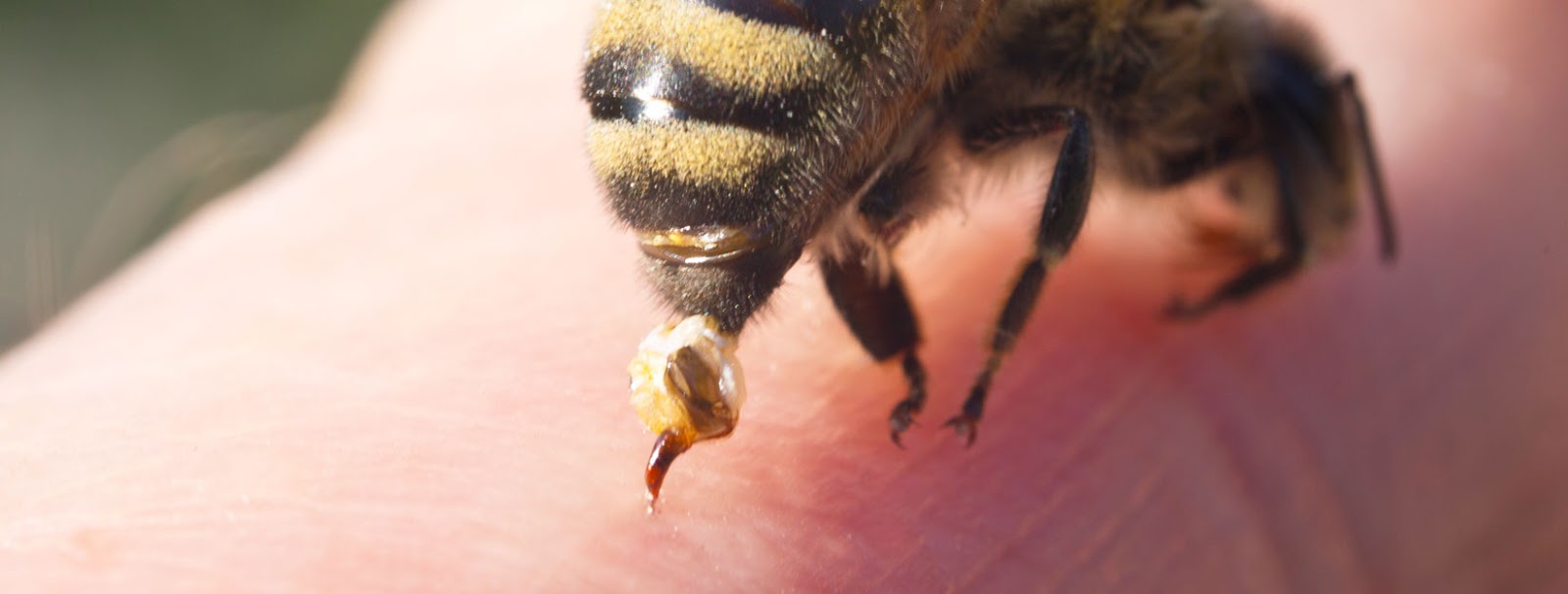 Снять укус пчелы. Пчелиный яд.