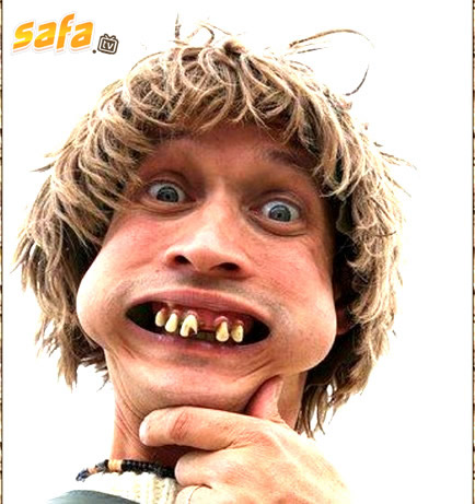 Funny teeth pics - ONLINE NEWS ICON