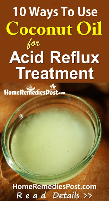 Coconut Oil For Acid Reflux, Coconut Oil And Acid Reflux, Home Remedies For Acid Reflux, Acid Reflux Treatment, How To Get Rid Of Acid Reflux, Acid Reflux Remedies, How To Get Relief From Acid Reflux, Acid Reflux Home Remedies, Treatment For Acid Reflux, How To Cure Acid Reflux, Relieve Acid Reflux, Acid Reflux Relief