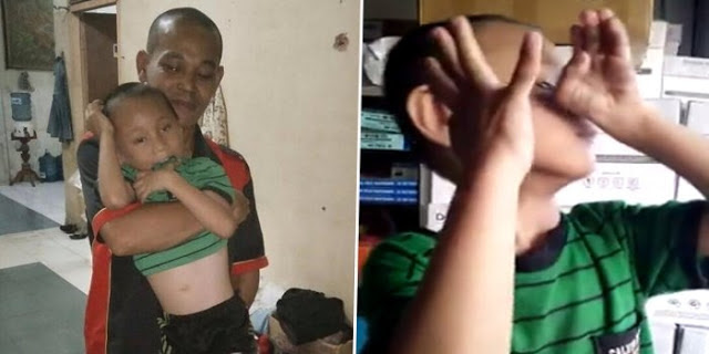 Ibu Ini Tinggalkan Anak nya Karena Malu Setelah Tahu Penyakit Anaknya