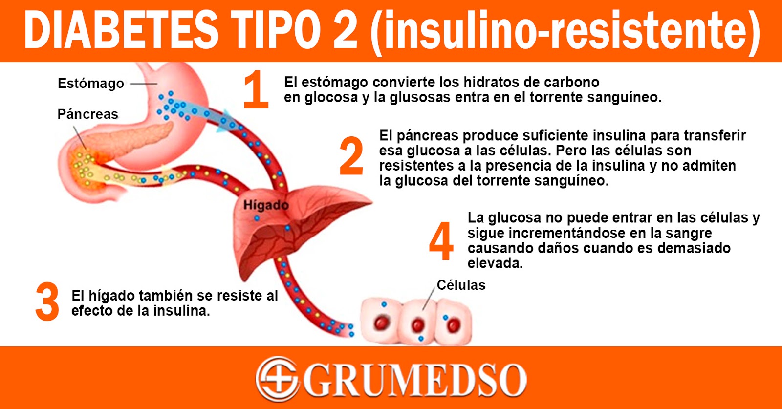 diabetes tipo 2 demasiados síntomas de azúcar